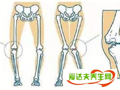 得了類風(fēng)濕怎么辦，類風(fēng)濕的治療方法有哪些