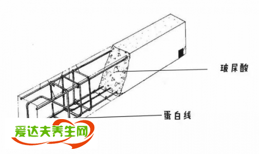 瑞藍(lán)玻尿酸分為幾種，瑞藍(lán)玻尿酸介紹