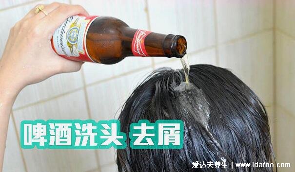 用啤酒洗頭好嗎有什么好處，去屑止癢/柔順發(fā)質(zhì)/防脫發(fā)(附步驟)