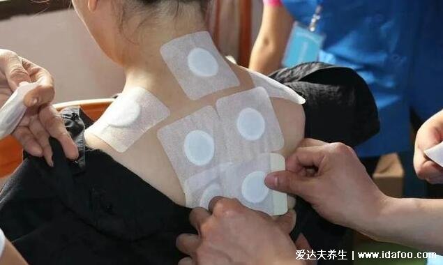 女人貼三伏貼有什么好處和禁忌小孩可以貼嗎，6大好處4種人禁用