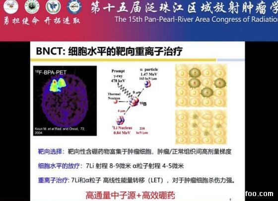 硼中子可以治療哪些腫瘤，有效治療頭頸部腫瘤等多種癌癥