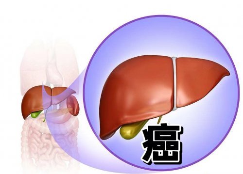 做好這3個檢查提早知道肝臟是否有問題